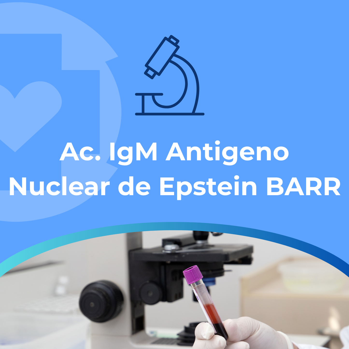 Ac. IgM Antigeno Nuclear de Epstein BARR