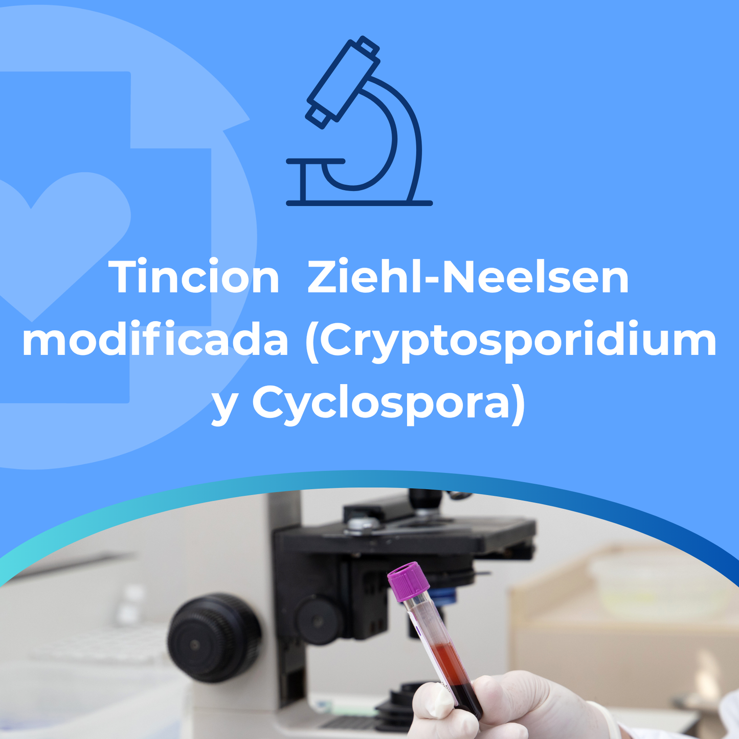 Tincion Ziehl-Neelsen modificada (Cryptosporidium y Cyclospora)