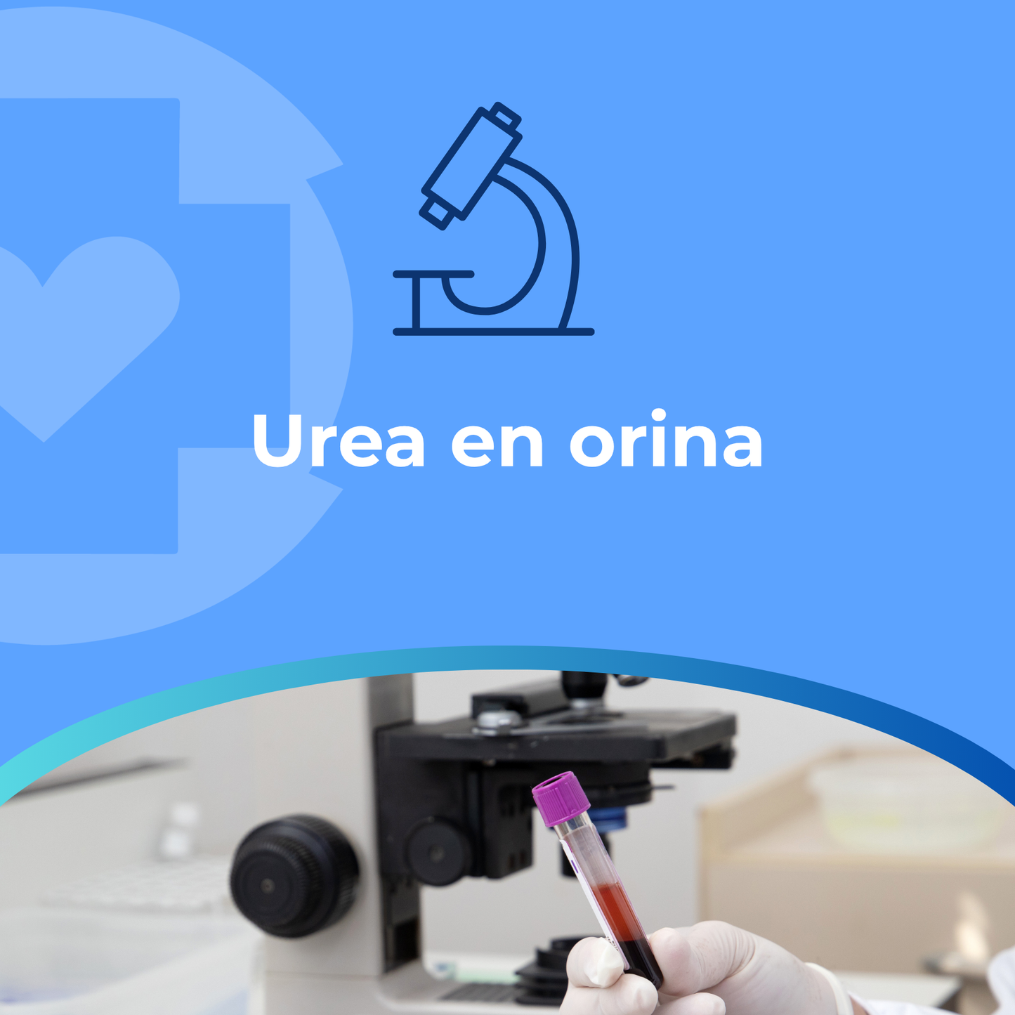 Urea en orina
