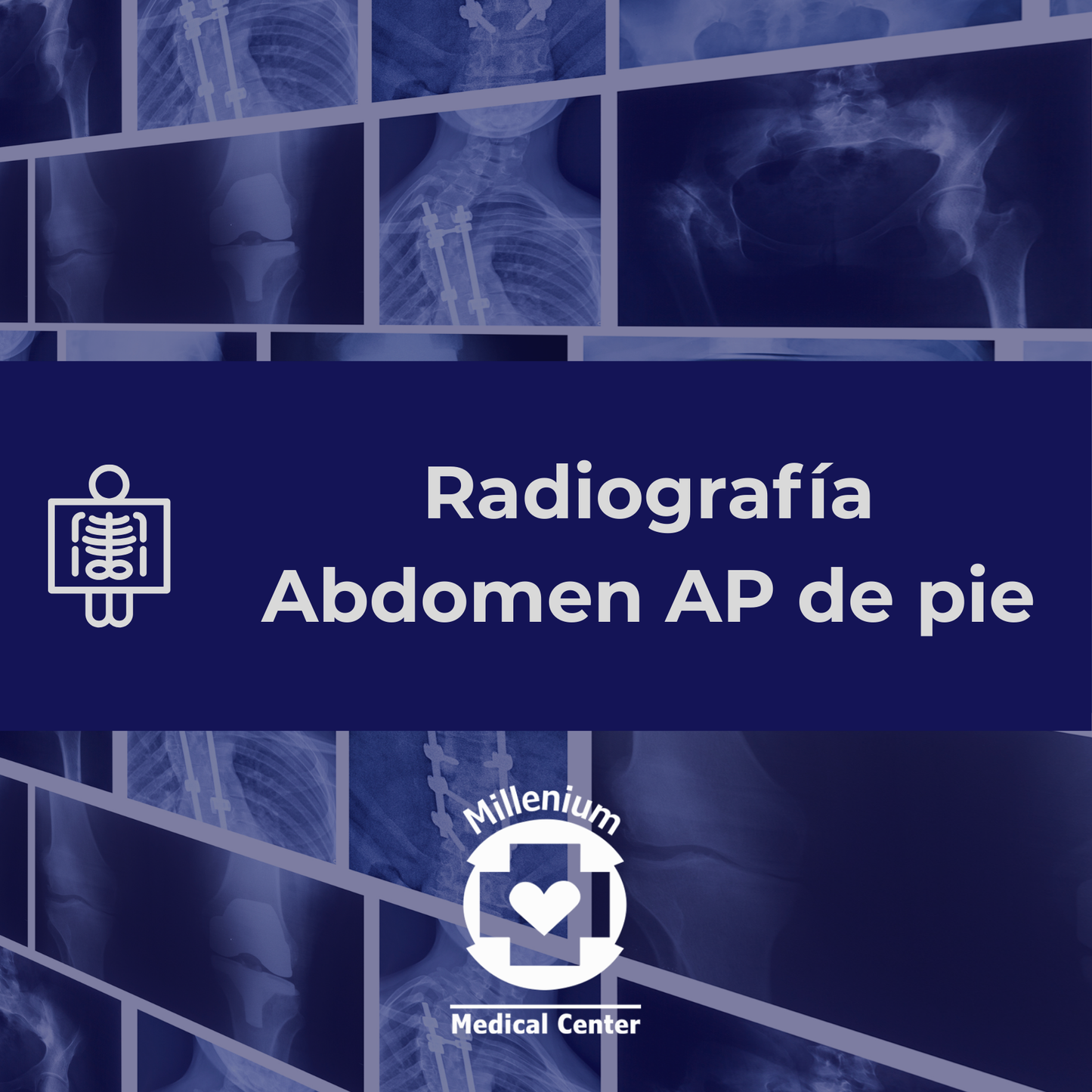 Abdomen ap de pie