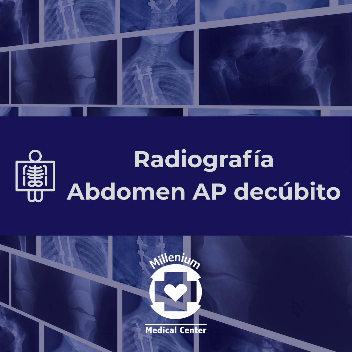 Abdomen ap decubito