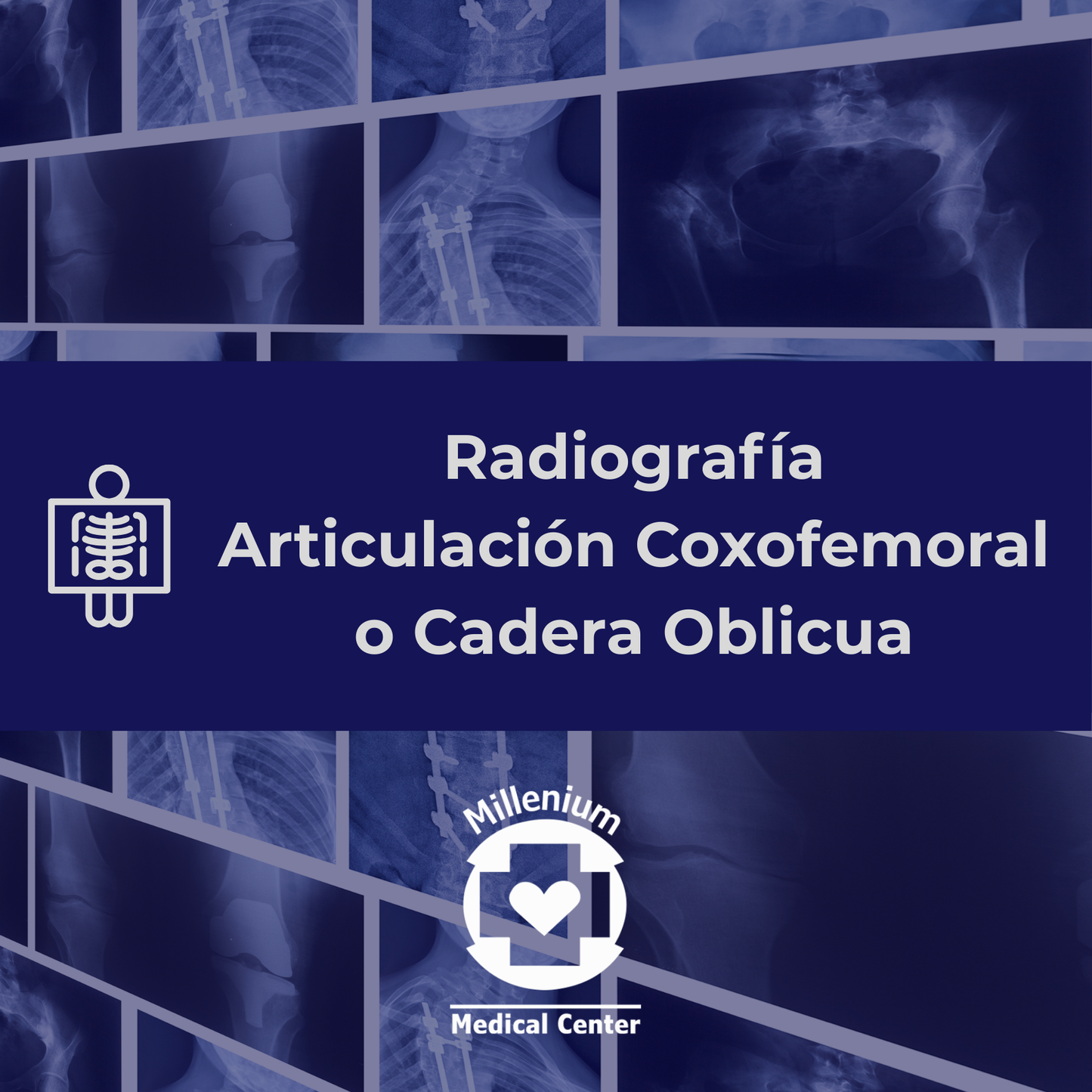 Articulacion coxofemoral o cadera oblicua