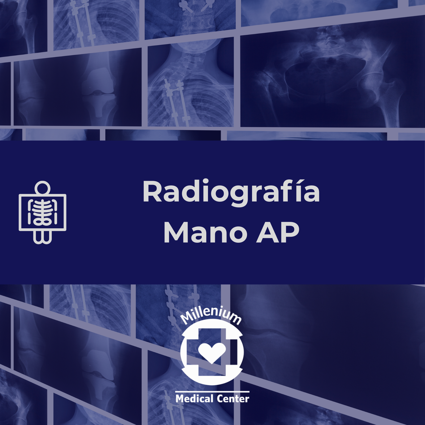 Mano ap