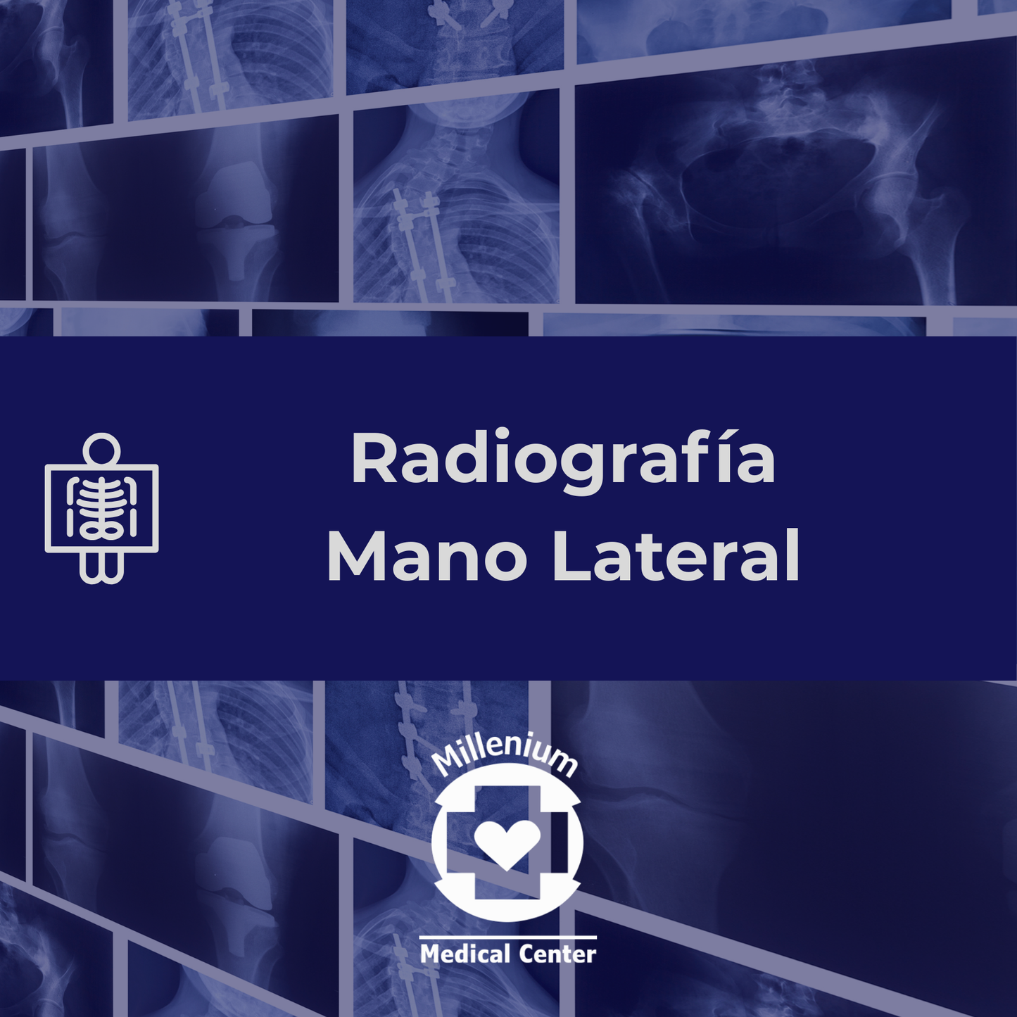 Mano lateral