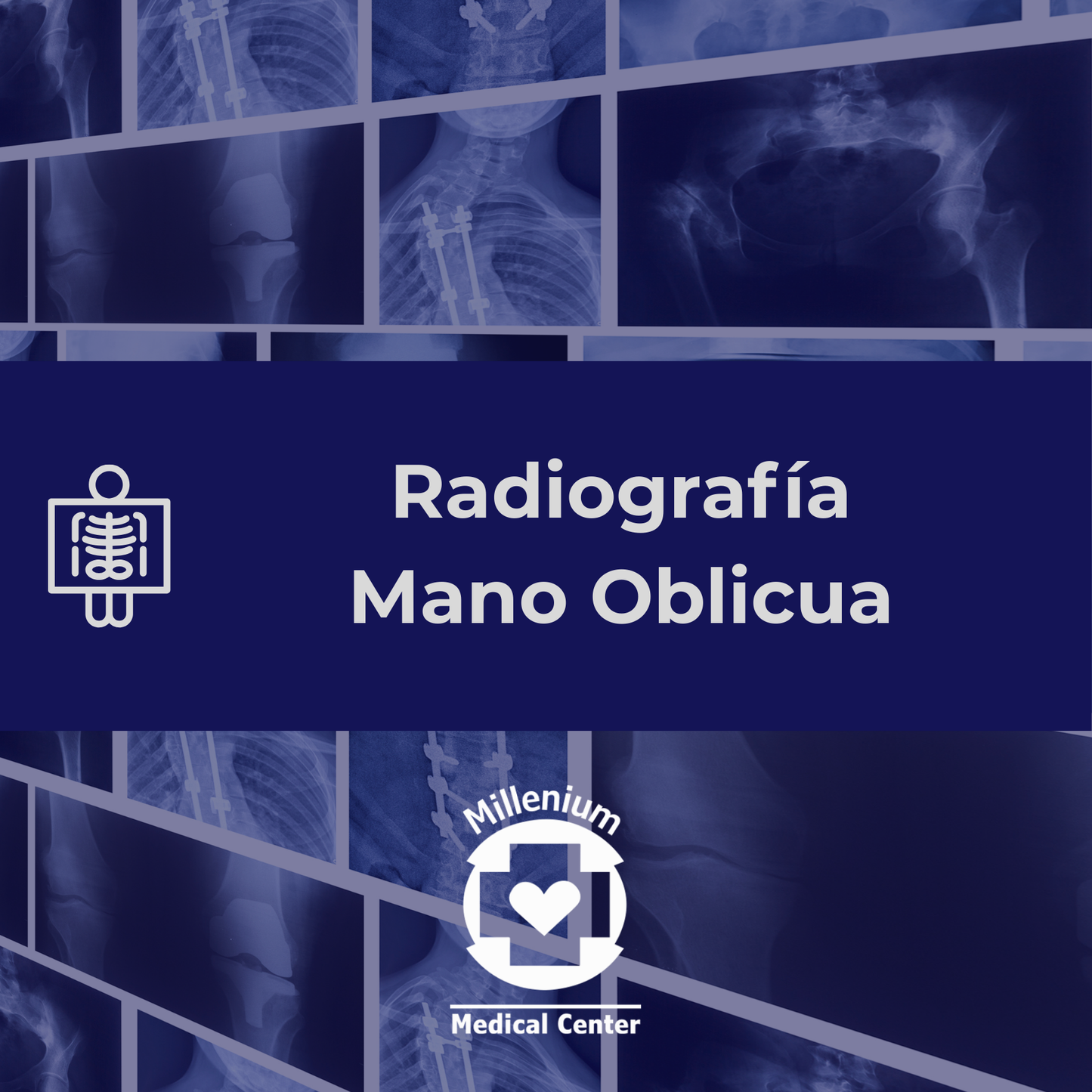 Mano oblicua