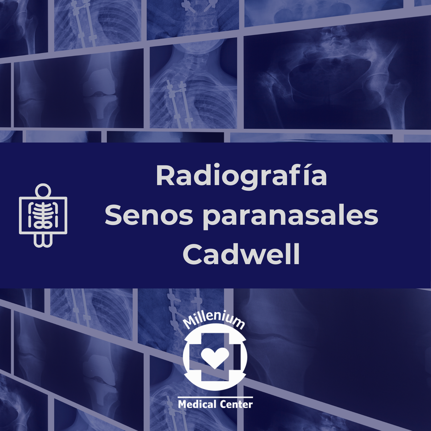 Senos paranasales cadwell
