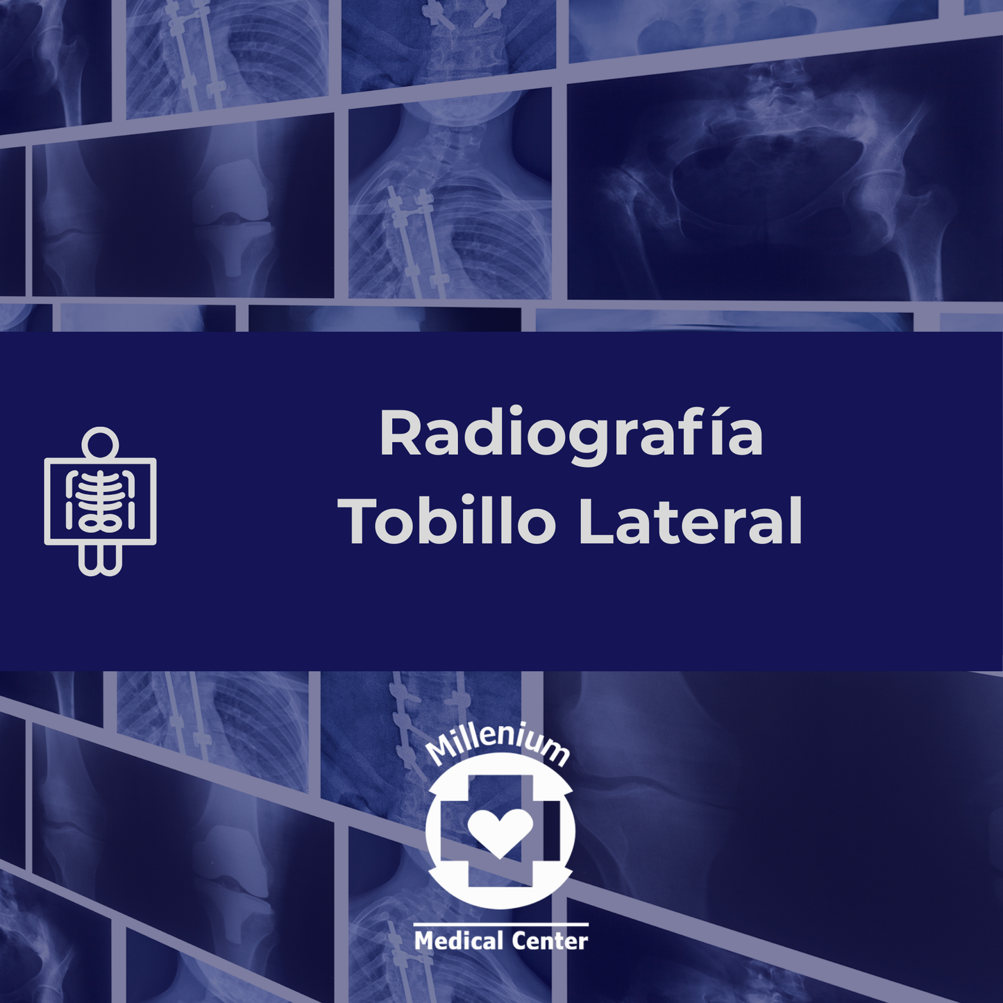 Tobillo lateral