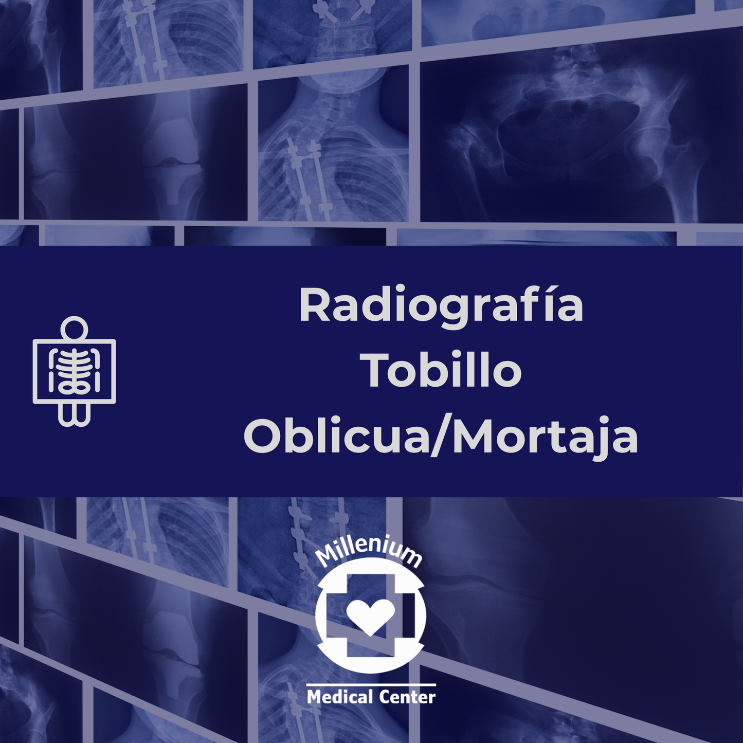 Tobillo oblicua/mortaja