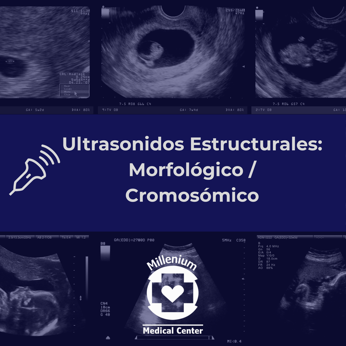 Ultrasonido Estructural: Morfológico (18/24.0 SDG), Cromosómico (12/14 SDG)