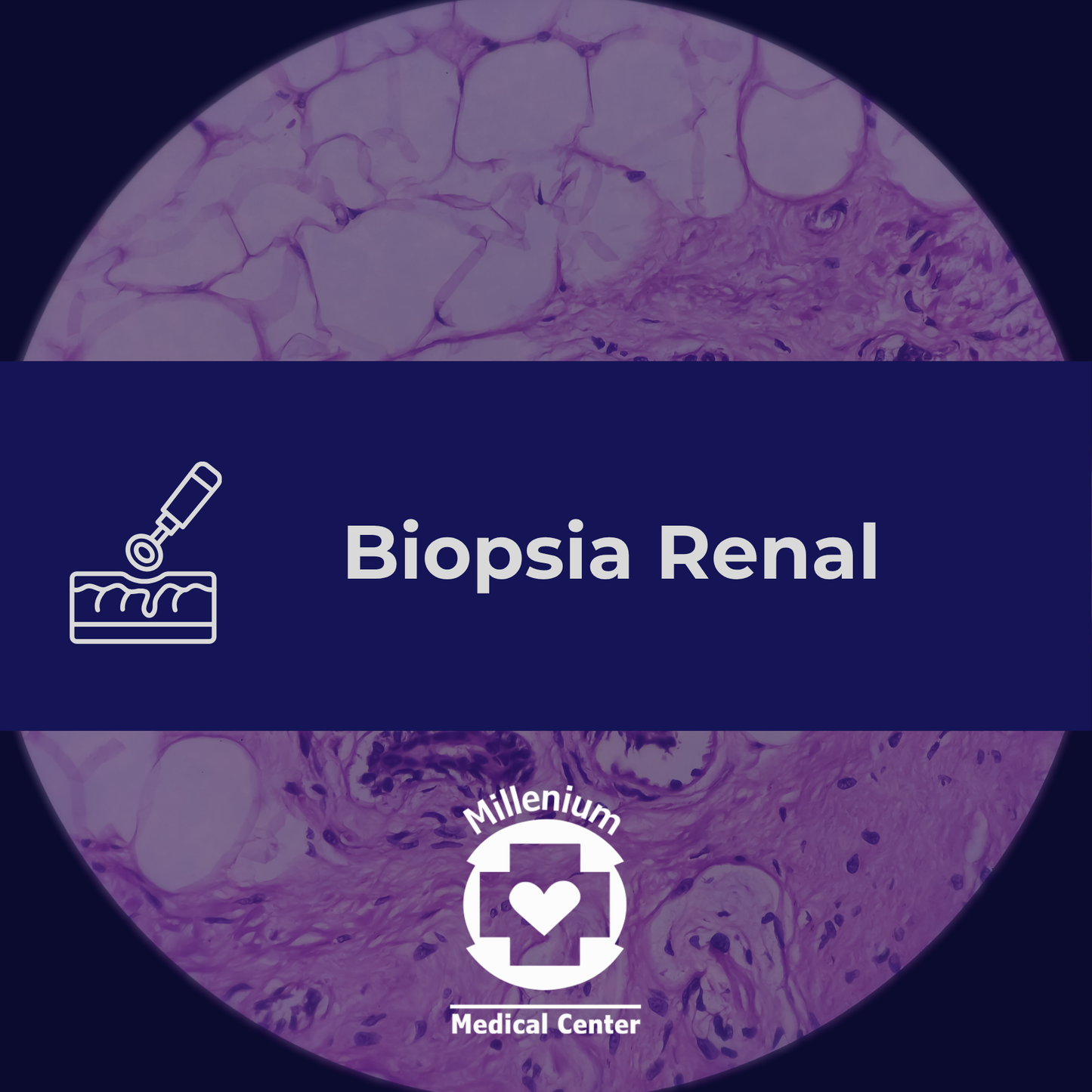 Biopsia Renal