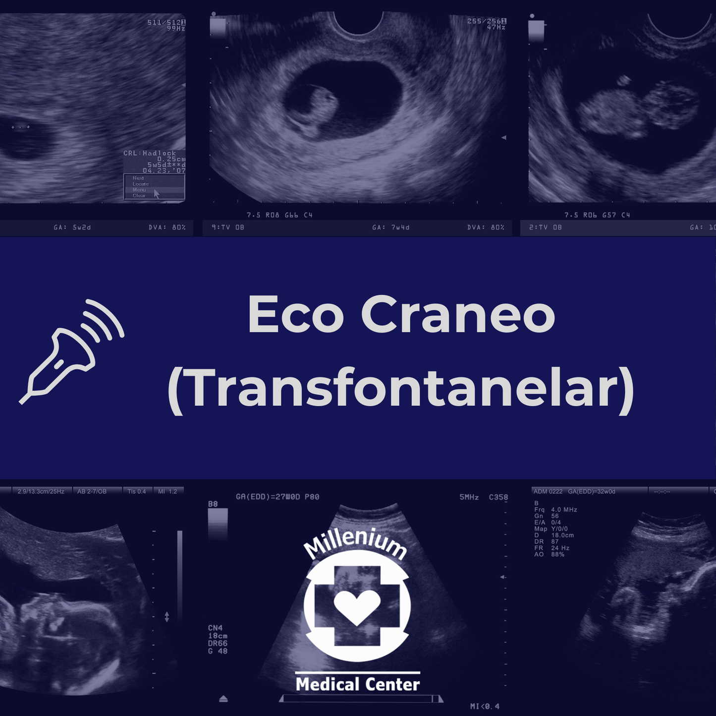 Eco Craneo (Transfontanelar) RN-2 meses max.