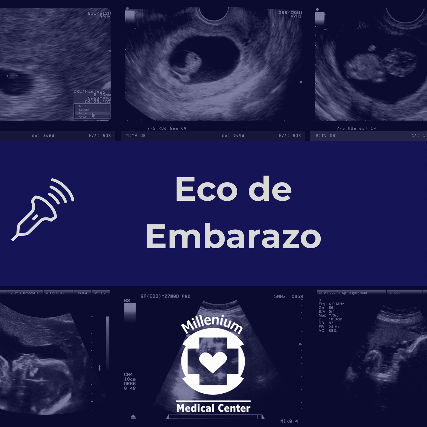 Eco de Embarazo