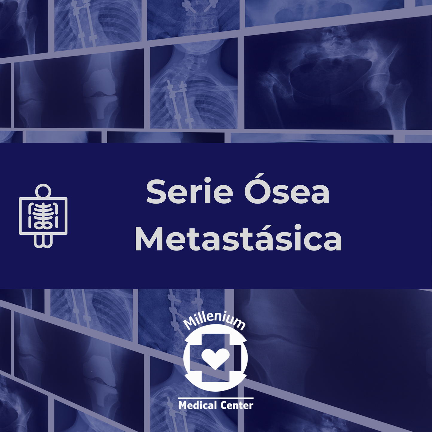 Serie Ósea Metastásica