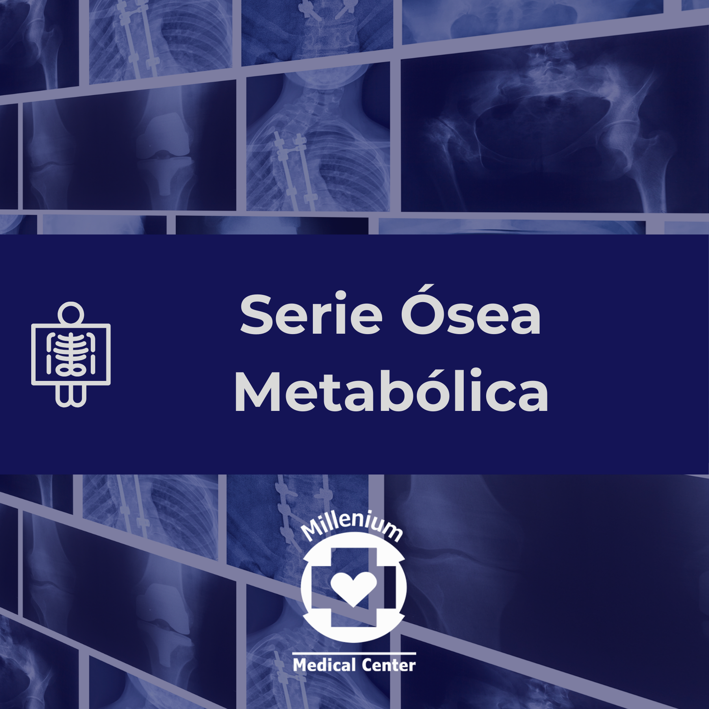 Serie Ósea Metabólica
