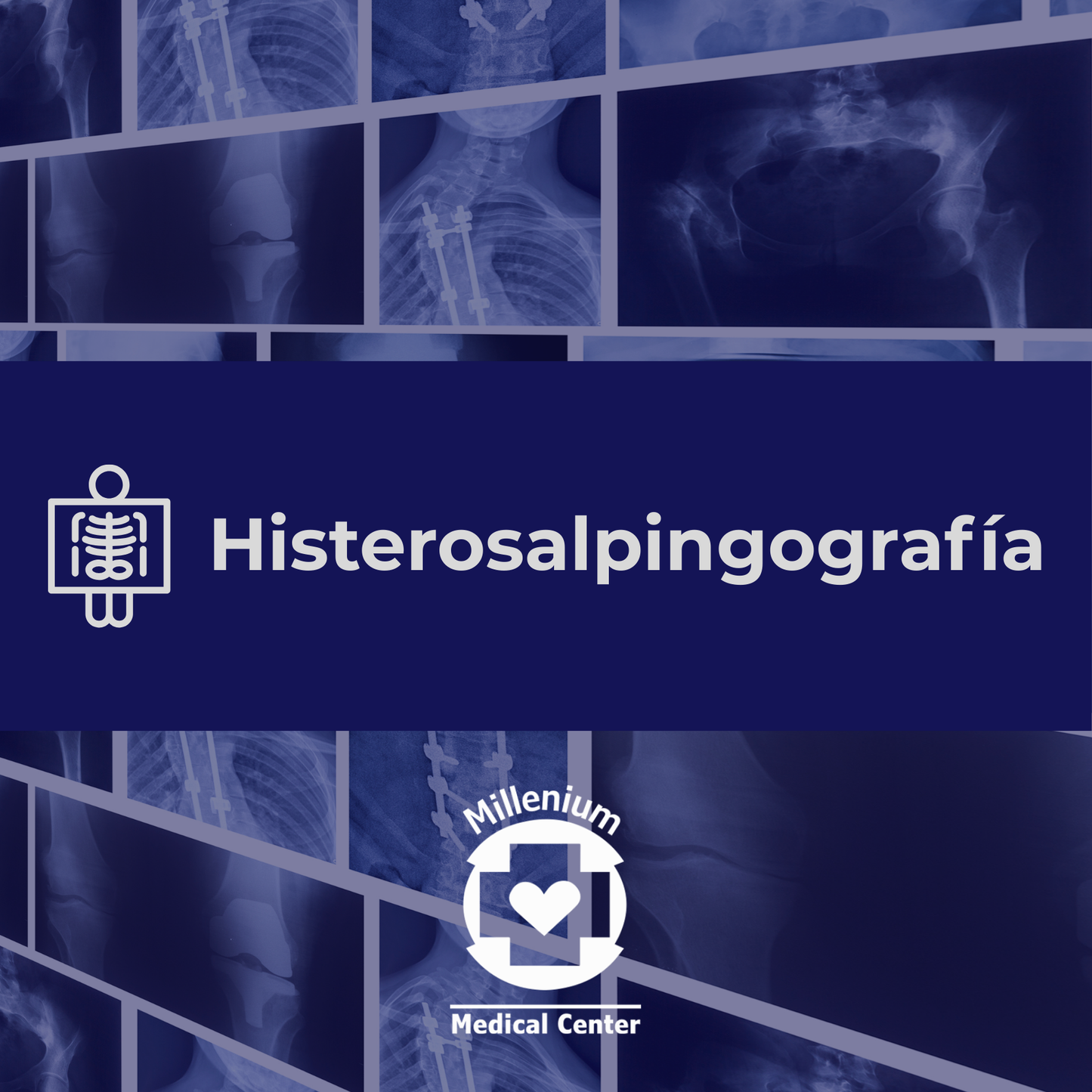 Histerosalpingografía
