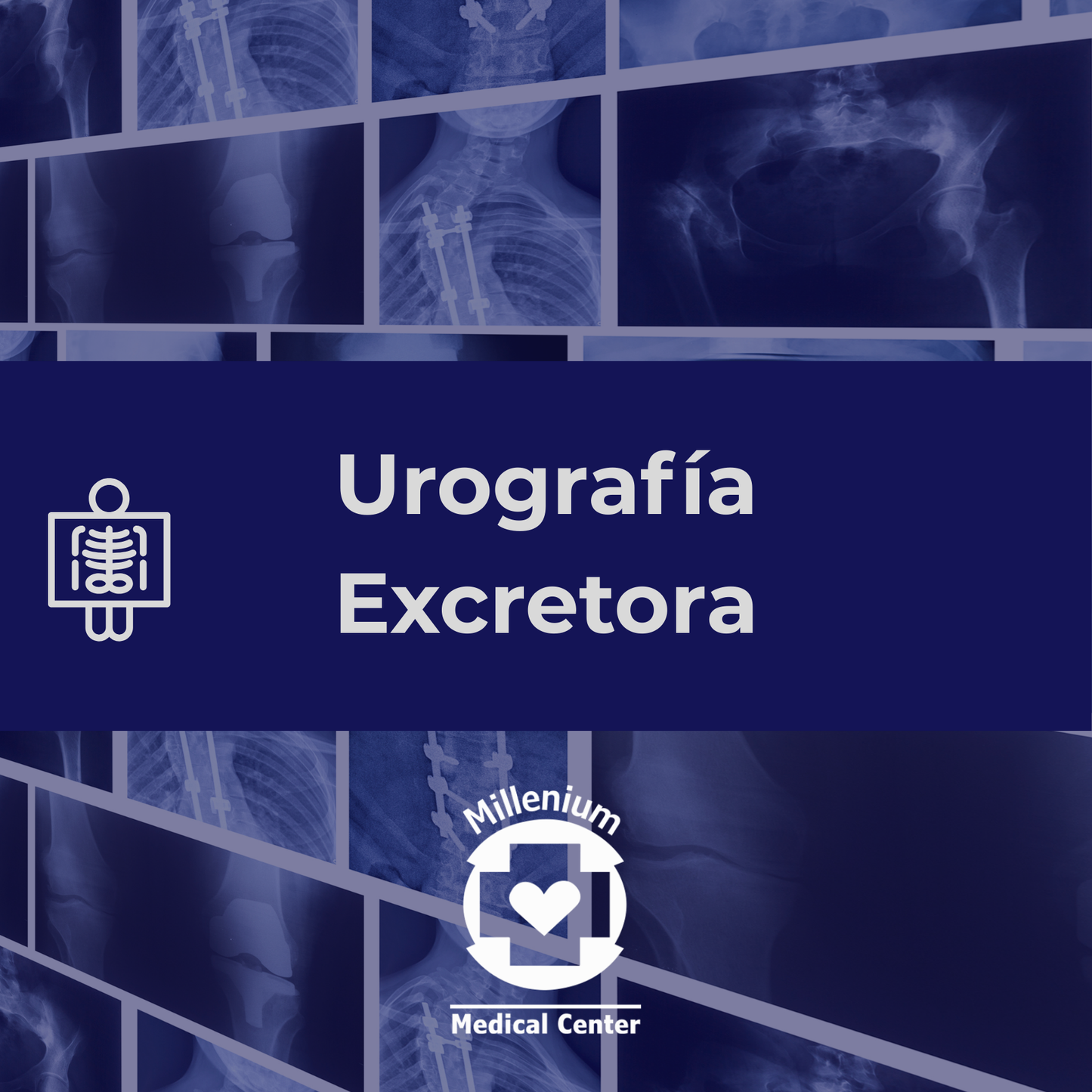 Urografía Excretora