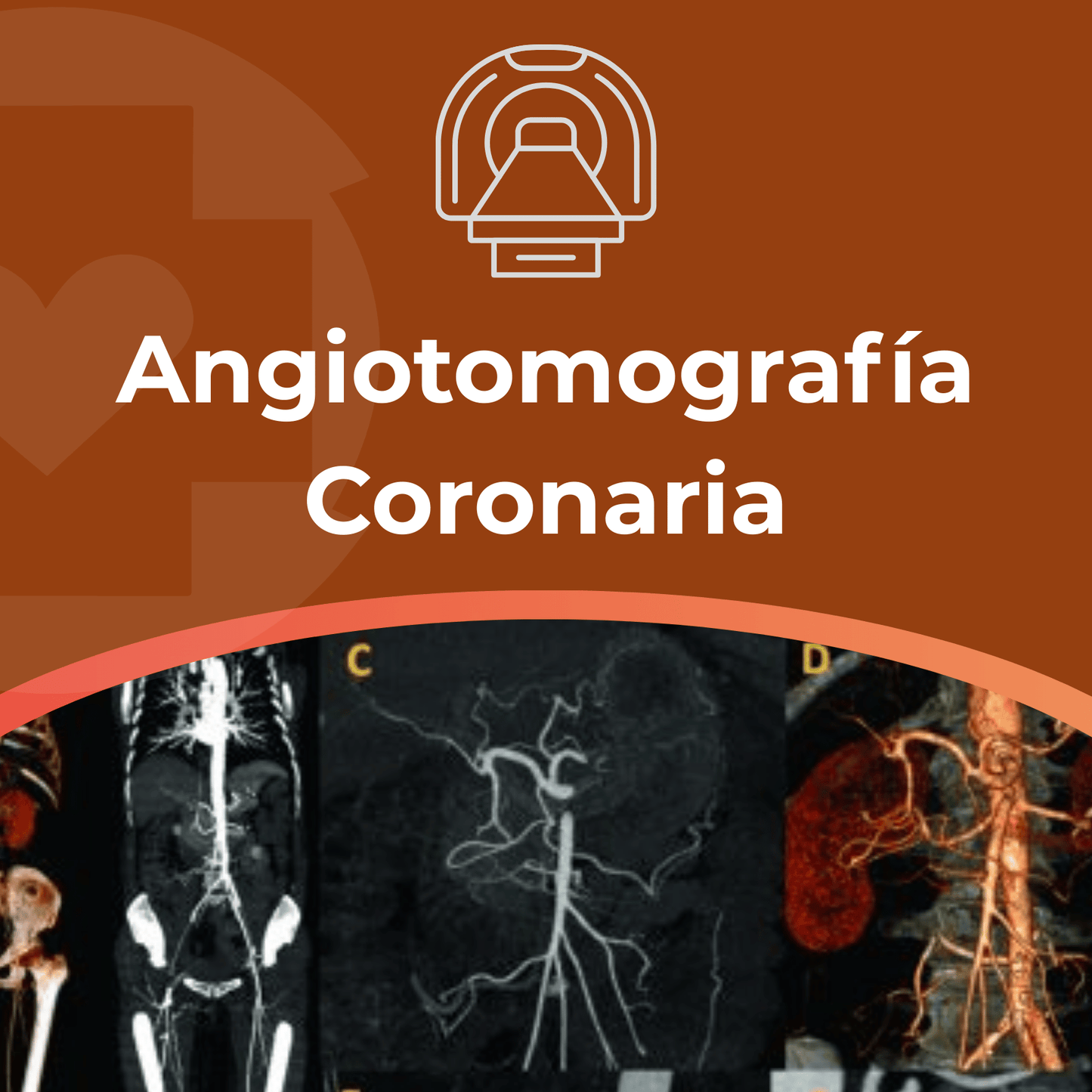 Angiotomografía Coronaria