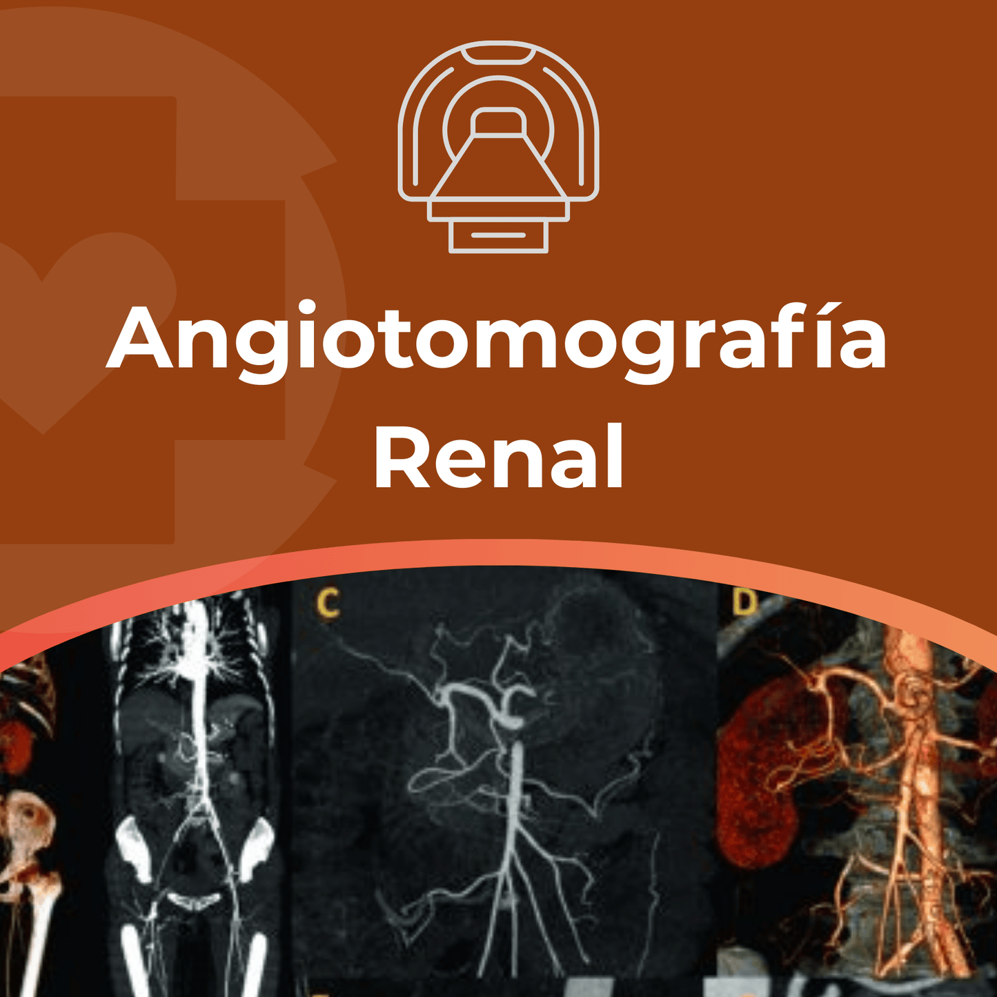 Angiotomografía Renal