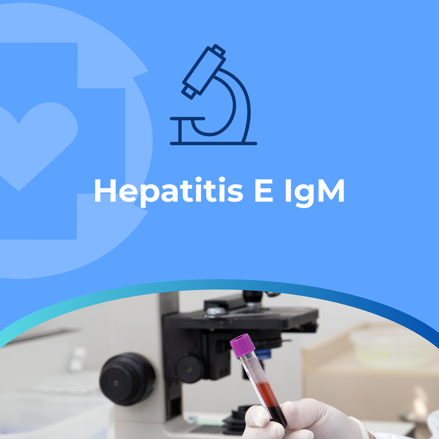 Hepatitis E IgM