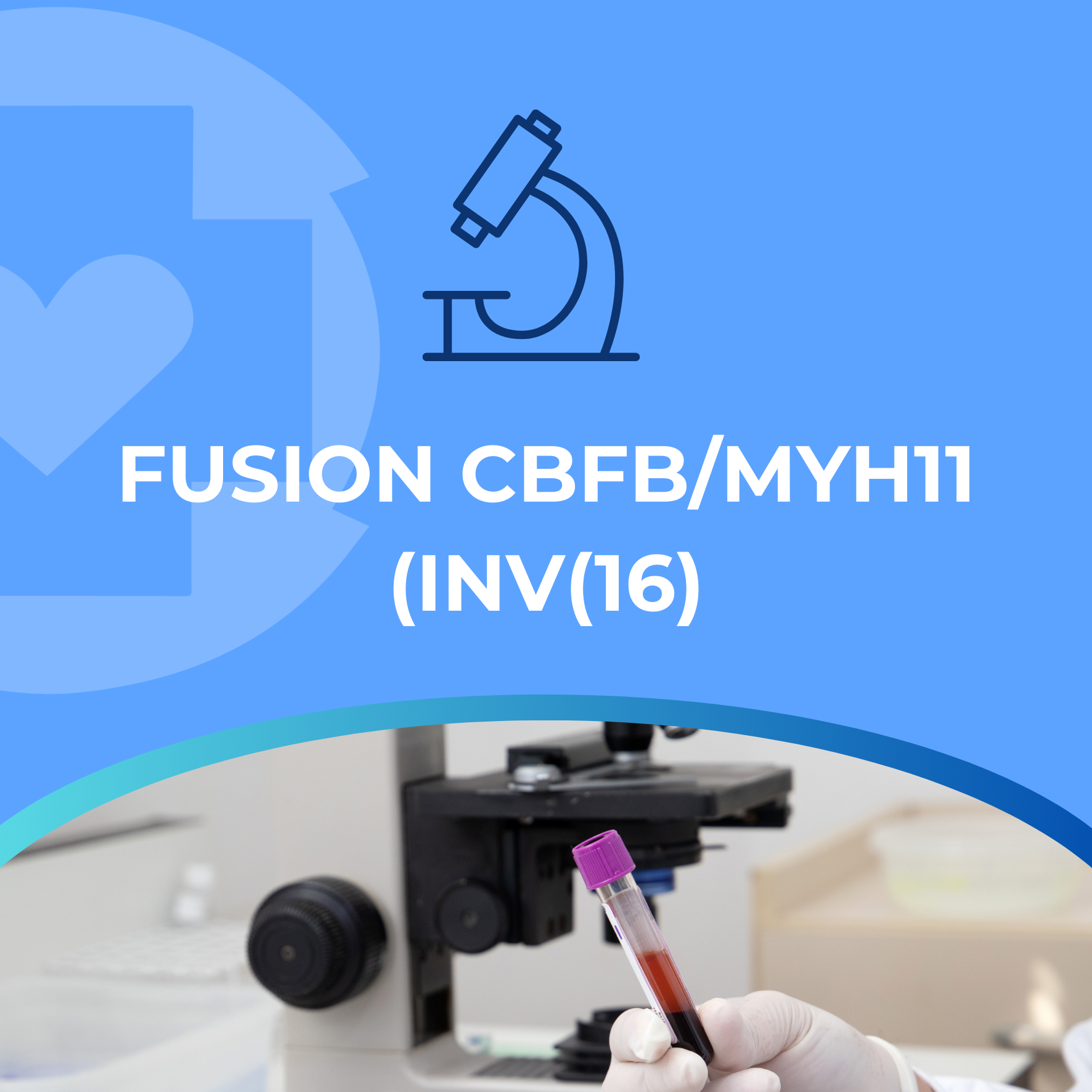 FUSION CBFB/MYH11 (INV(16) – Hospital Millenium