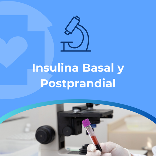 Insulina Basal y Postprandial