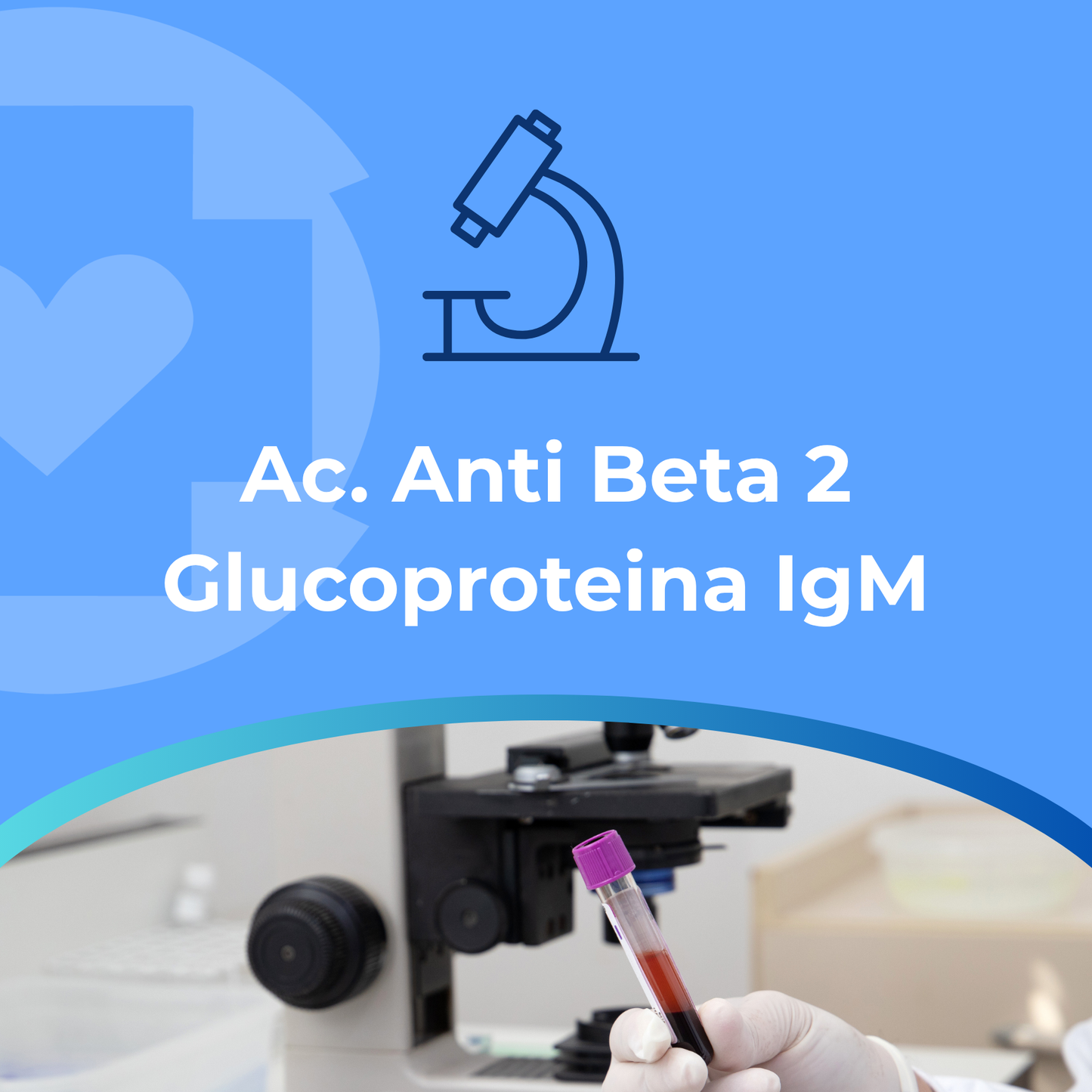 Ac. Anti Beta 2 Glucoproteina IgM