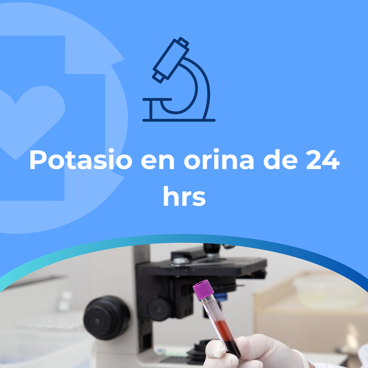 Potasio en orina de 24 hrsPERFIL