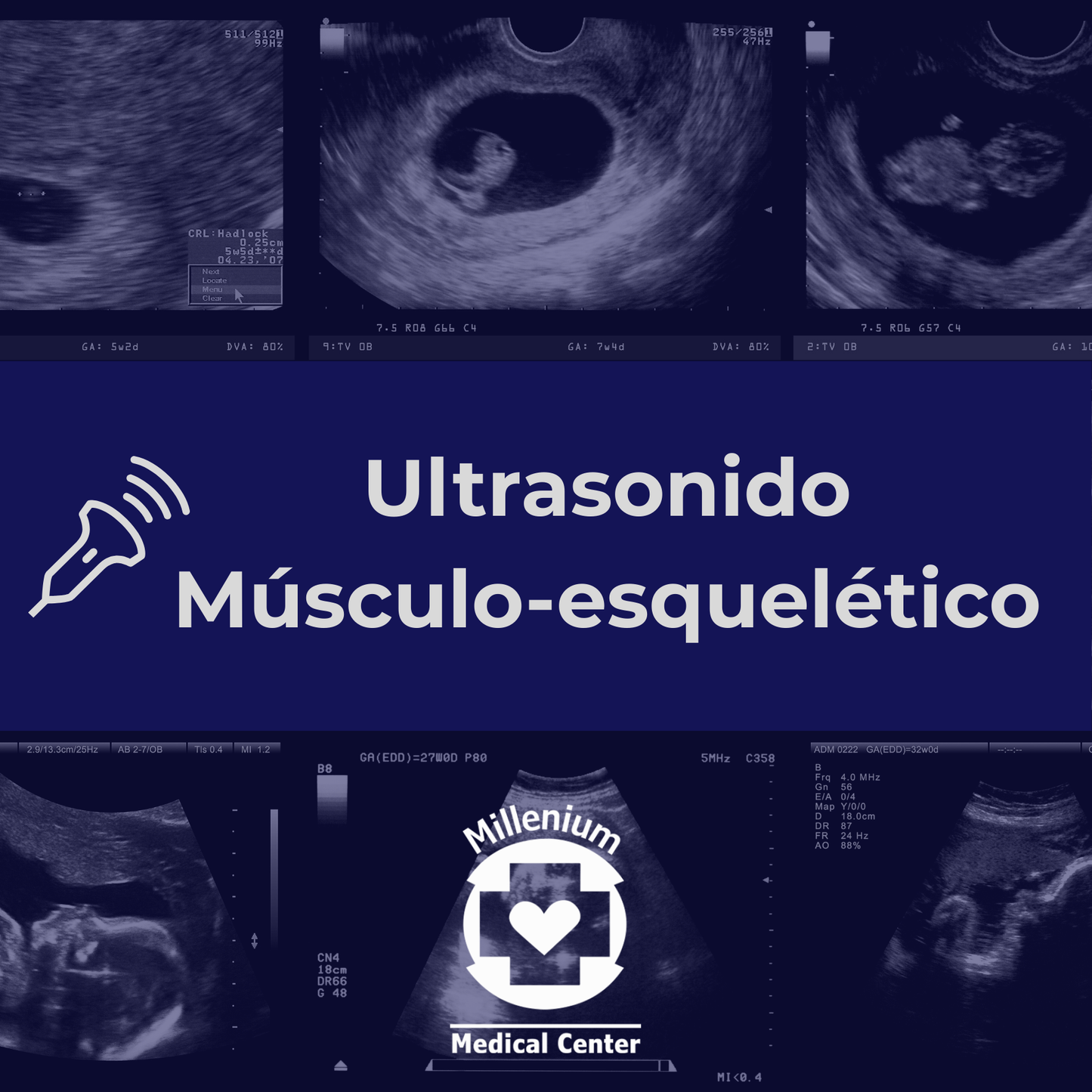Ultrasonido Musculo Esquelético
