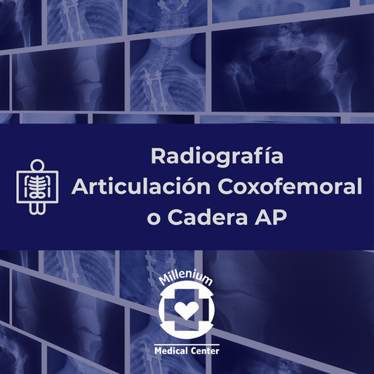 Articulacion coxofemoral o cadera ap