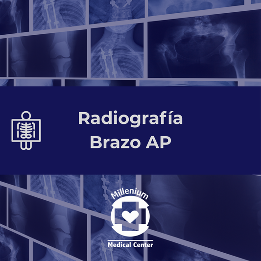 Brazo ap