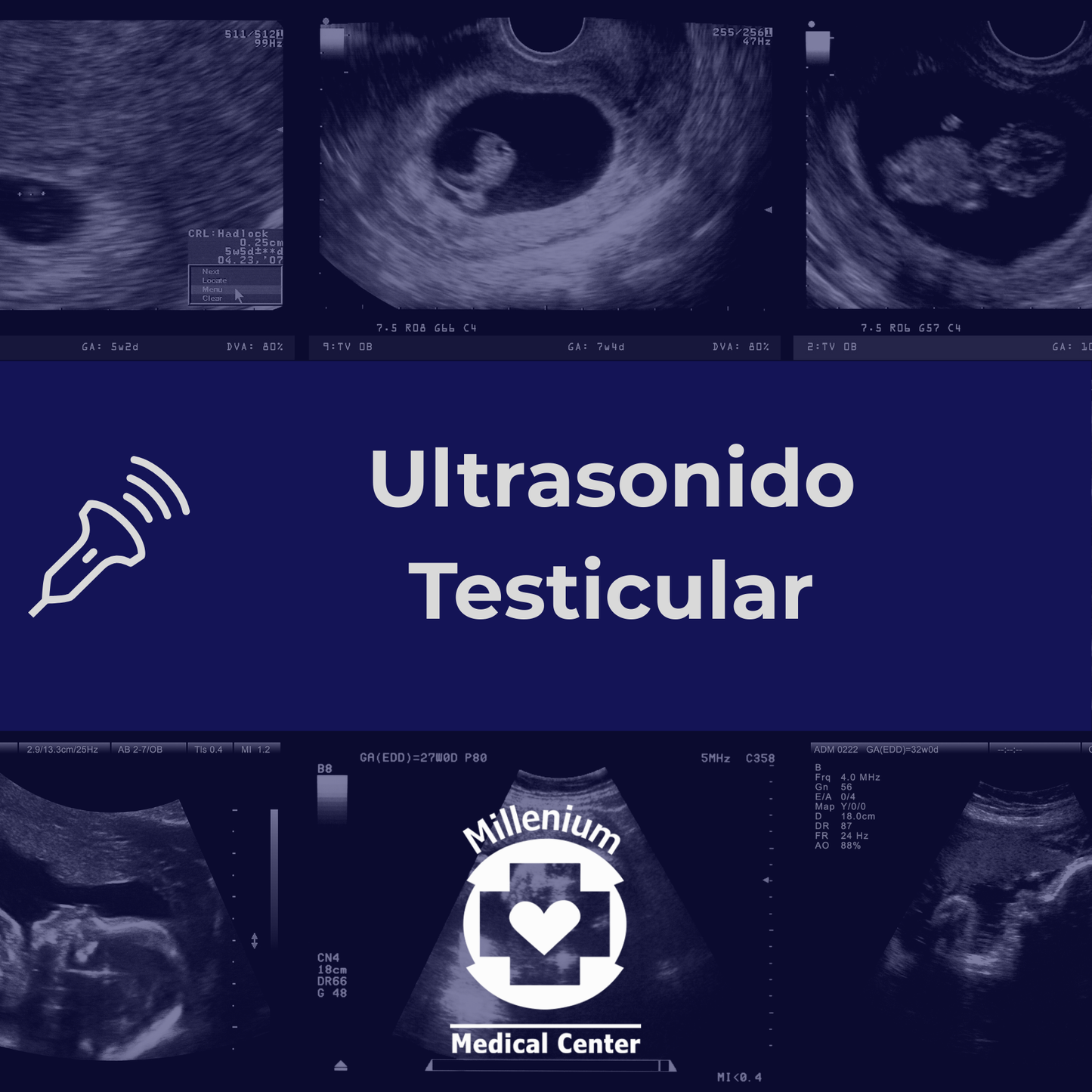 Ultrasonido Testicular