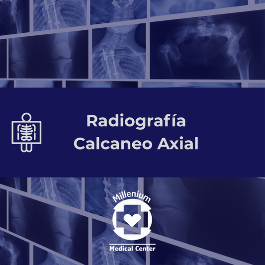 Calcaneo axial