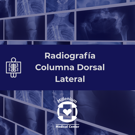 Columna dorsal lateral