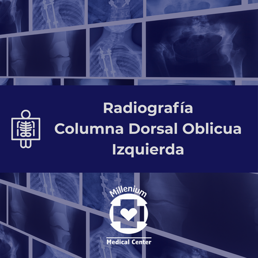 Columna dorsal oblicua izquierda