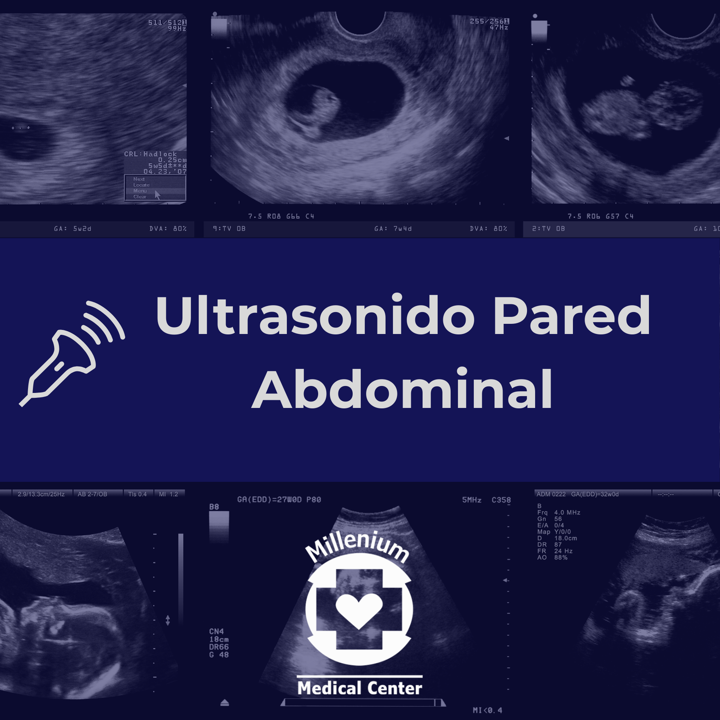 Ultrasonido Pared Abdominal