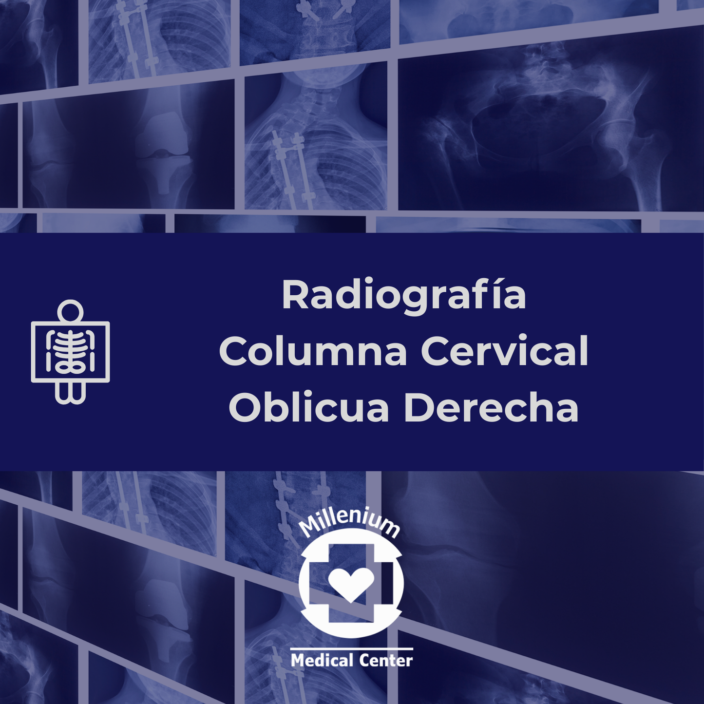 Columna cervical oblicua derecha