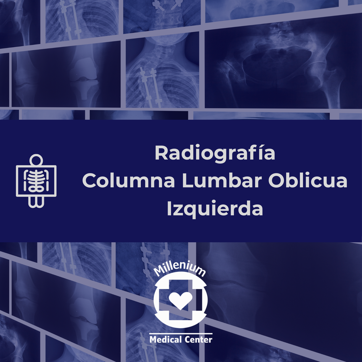 Columna lumbar oblicua izquierda
