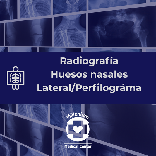 Huesos nasales lateral/perfilograma