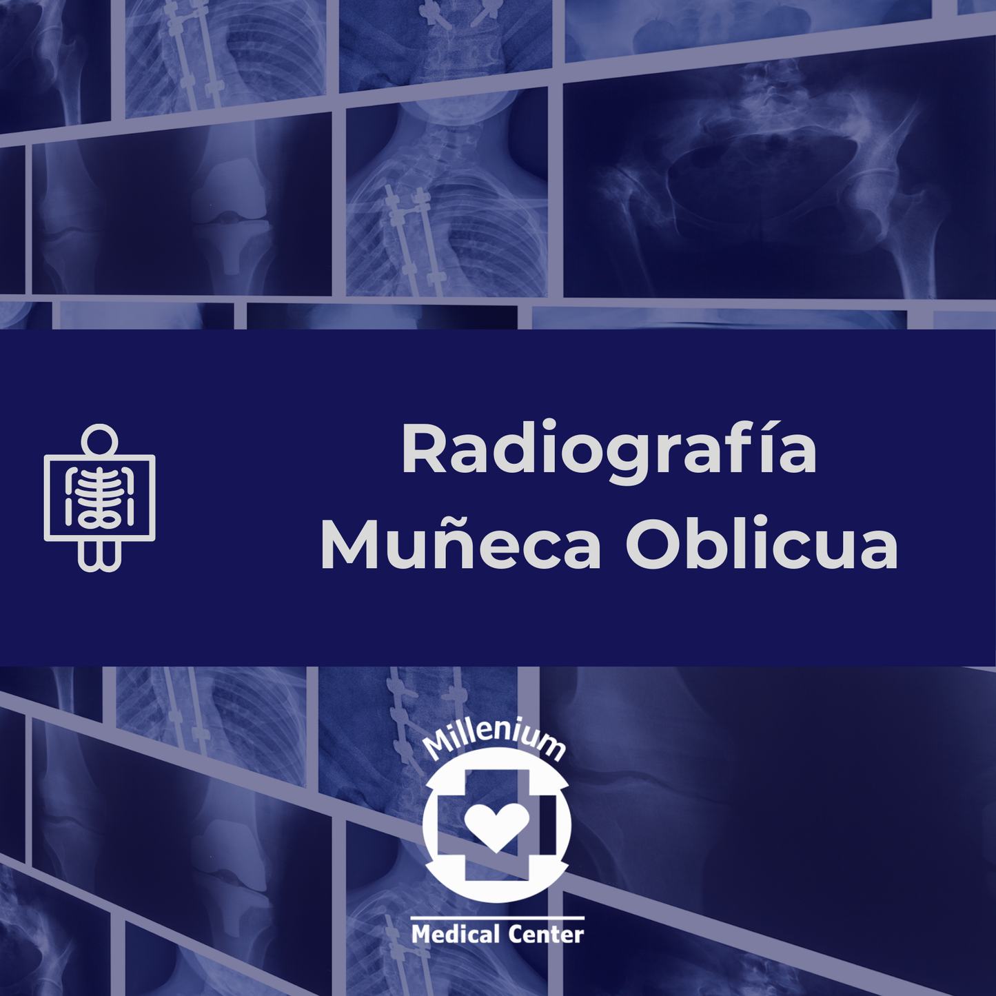 Muñeca Oblicua