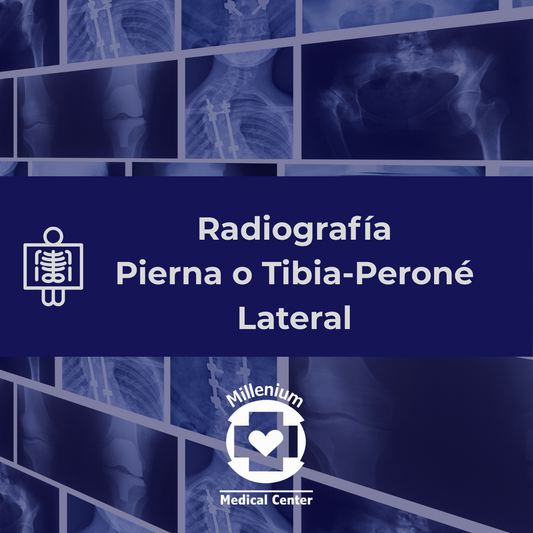 Pierna o tibia-perone lateral