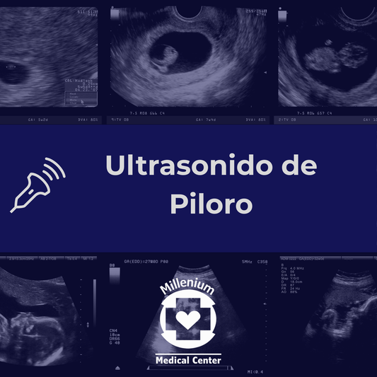 Ultrasonido de Piloro