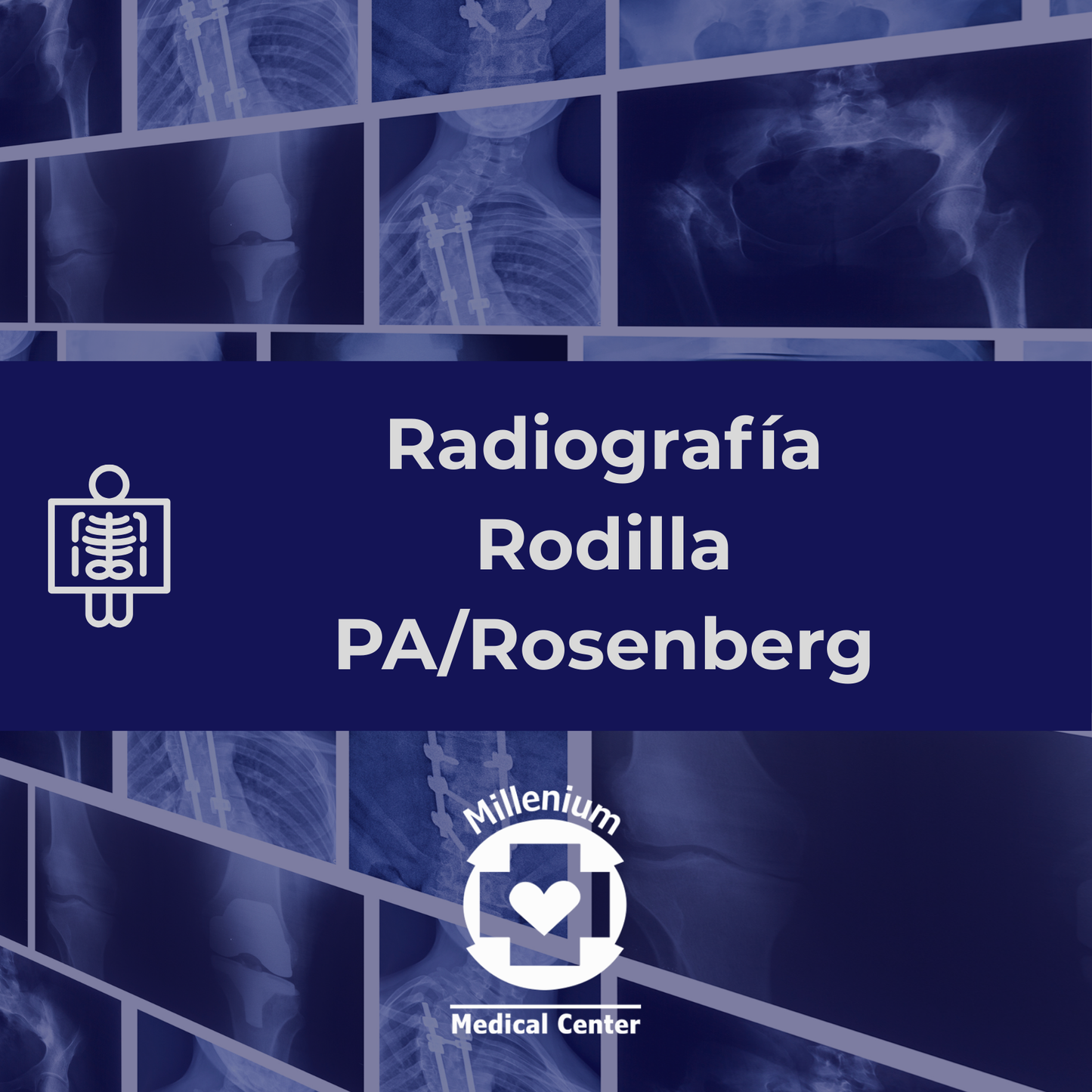Rodilla pa/rosenberg