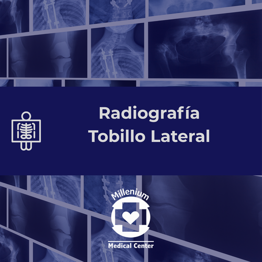 Tobillo lateral