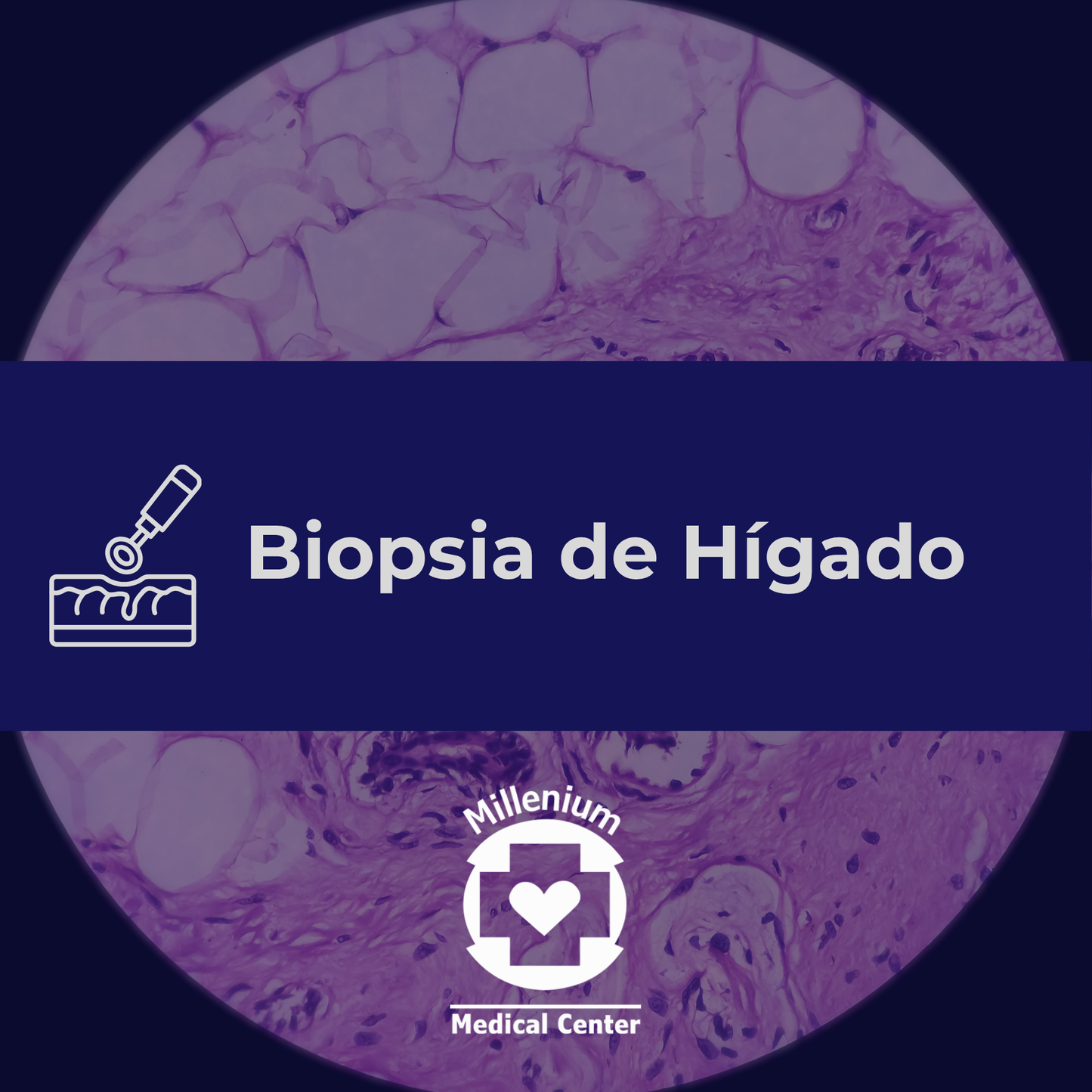 Biopsia Hígado