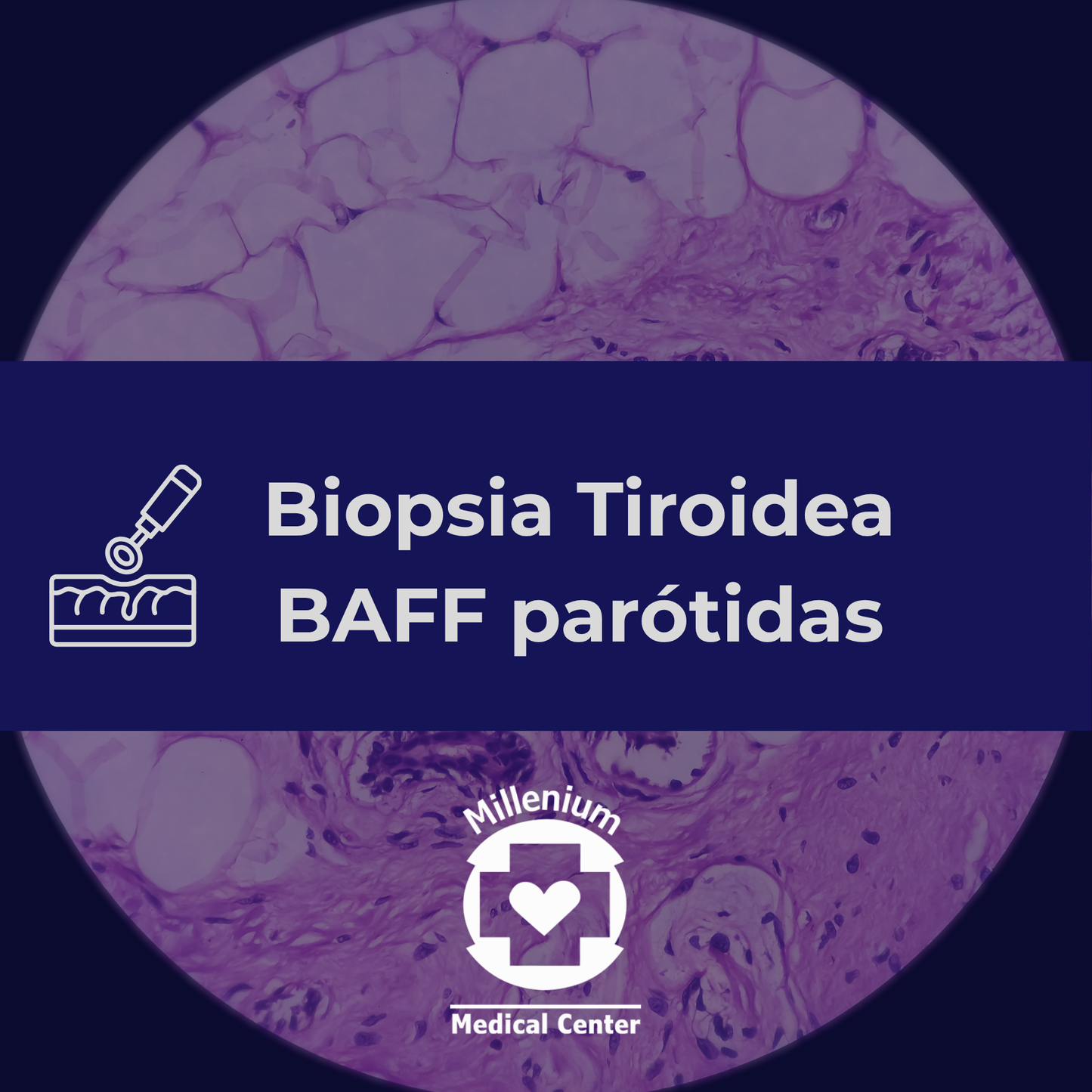 Biopsia Tiroidea BAFF. parótidas