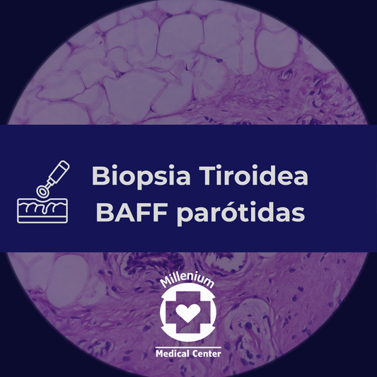 Biopsia Tiroidea BAFF. parótidas