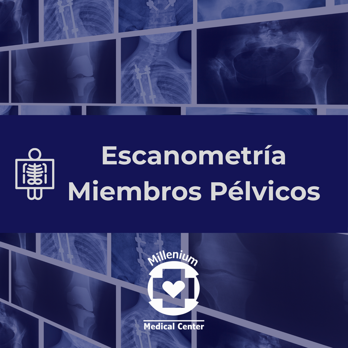 Escanometría Miembros Pélvicos