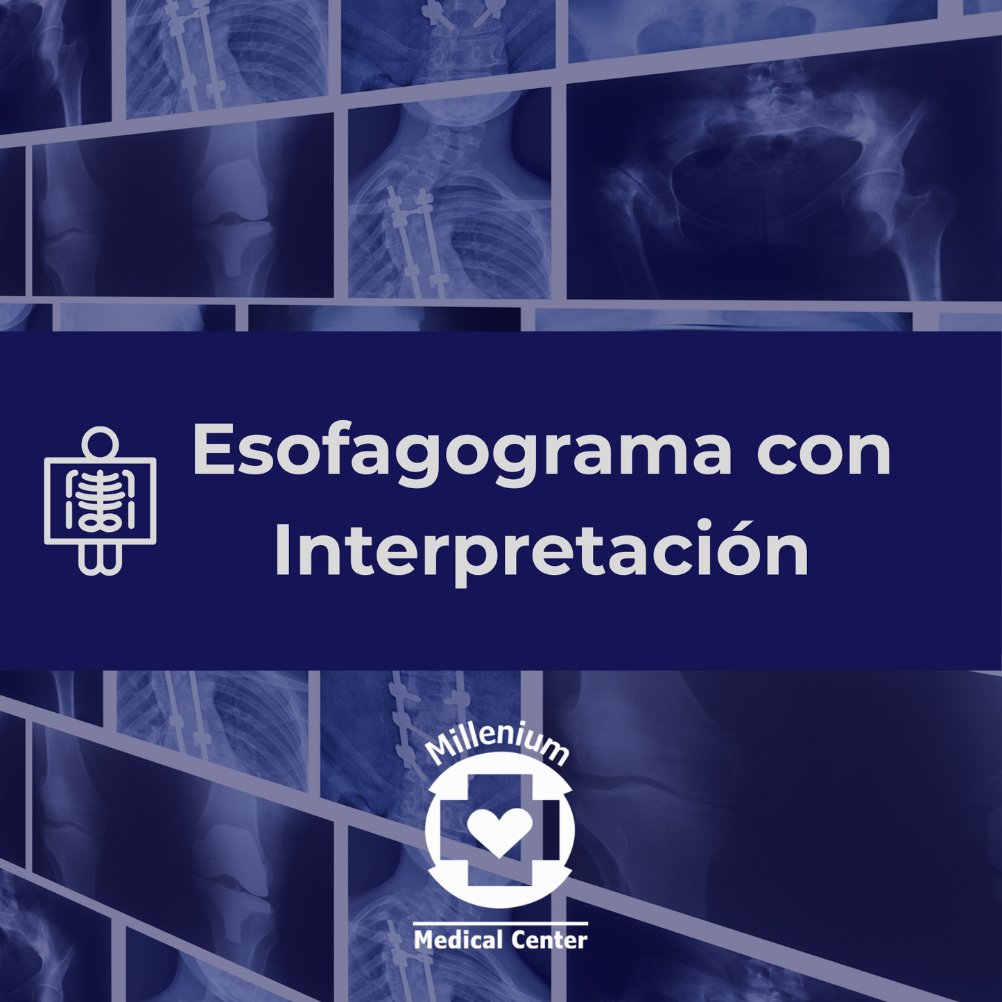 Esofagograma Interpretado