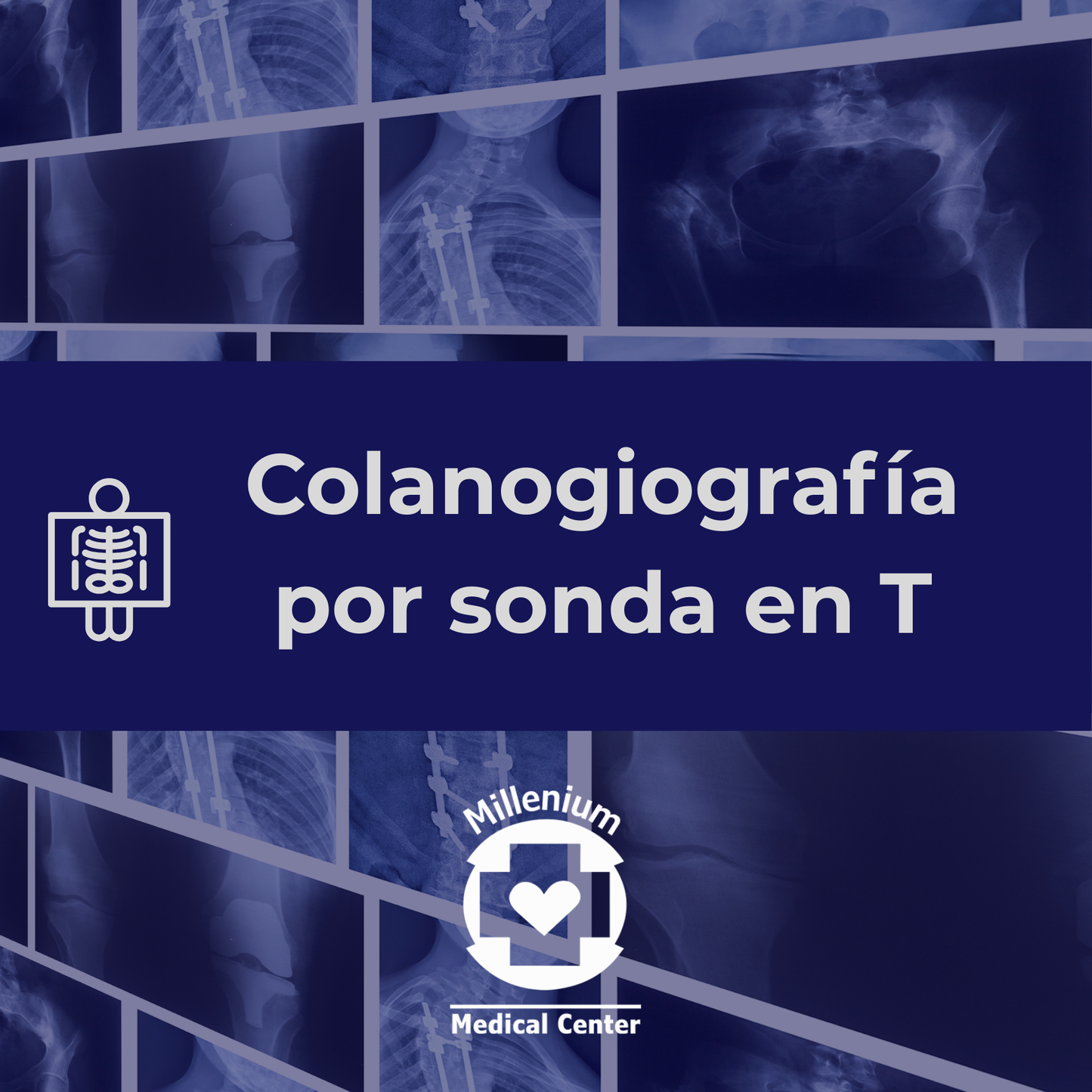 Colanogiografía por sonda en T
