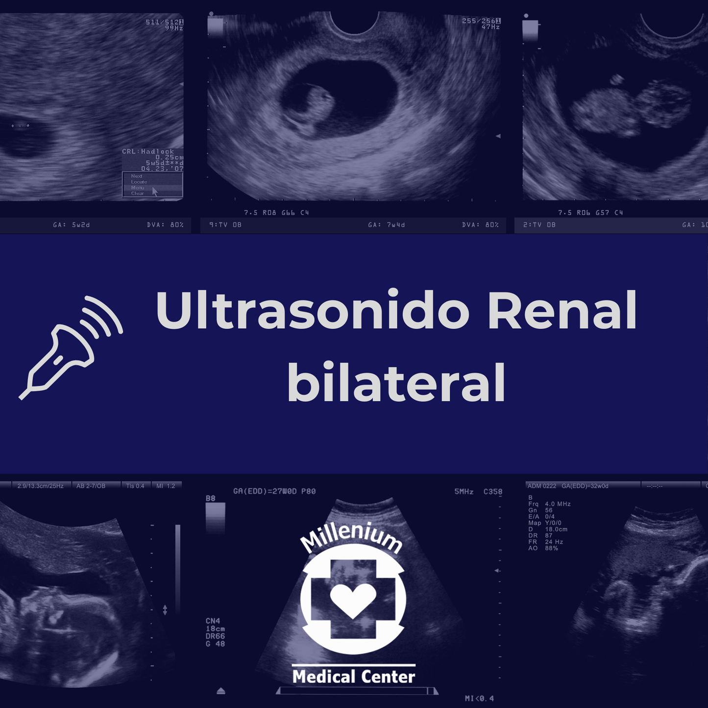 Ultrasonido Renal Bilateral